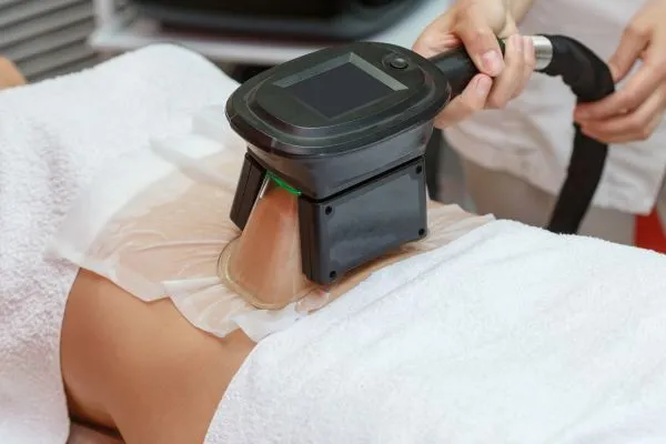 Image of person having fat freezing treatment to help weight gain Salford Priors
