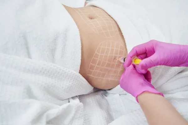 image of fat dissolving injections on love handles to help combat weight gain Salford Priors