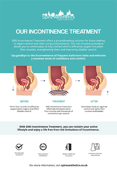 image of how urge incontinence Salford Priors treatment works