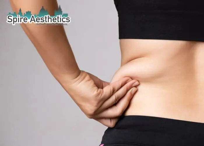 Image of woman pinching fat on their hips Salford Priors. Fat Freezing treatment