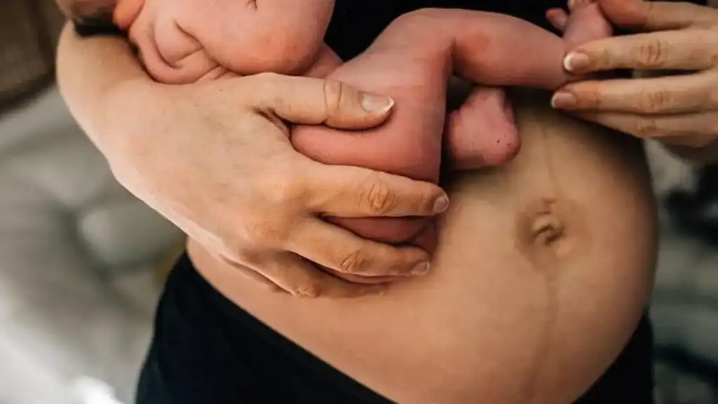 Why Is My Stomach Still Big After Pregnancy Salford Priors?